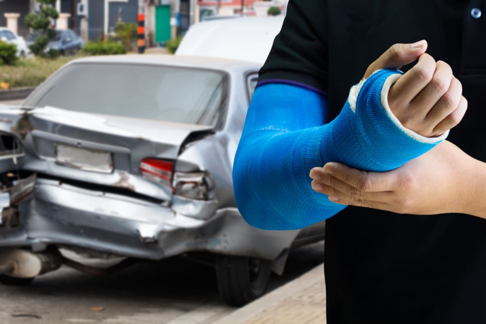 Close-up of man's hand with blue bandage, symbolizing arm injury from car accident.